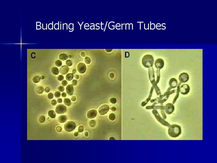 Budding Yeast/Germ Tubes 