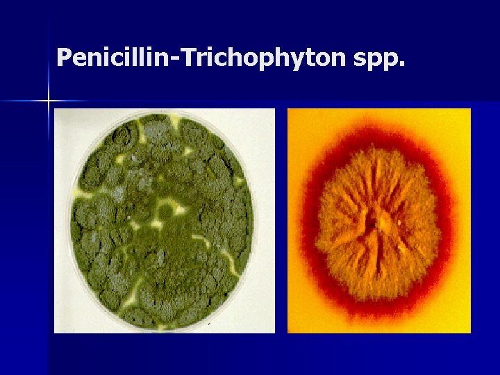 Penicillin-Trichophyton spp. 