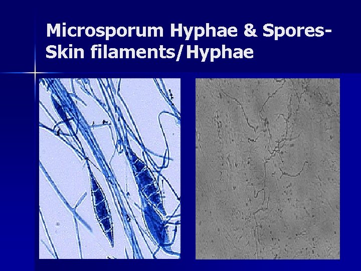 Microsporum Hyphae & Spores. Skin filaments/Hyphae 