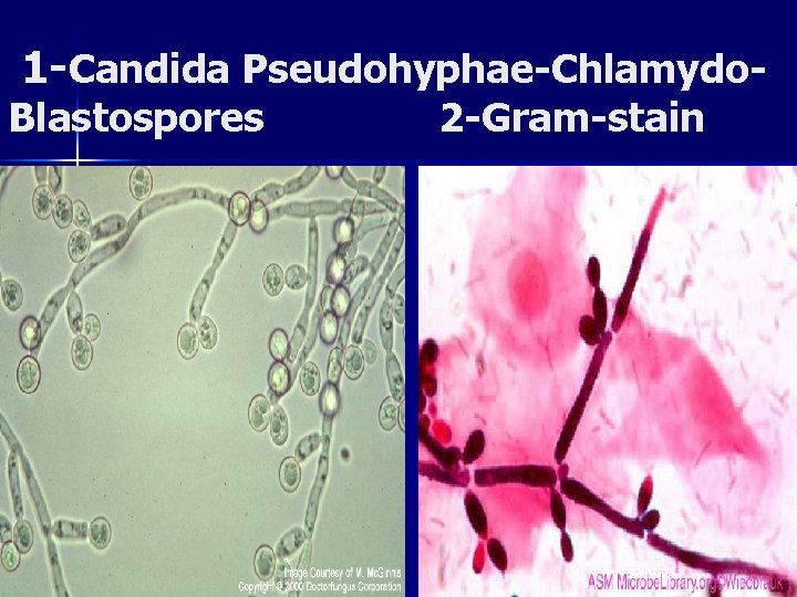 1 -Candida Pseudohyphae-Chlamydo- Blastospores 2 -Gram-stain 