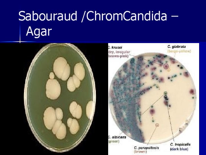 Sabouraud /Chrom. Candida – Agar 