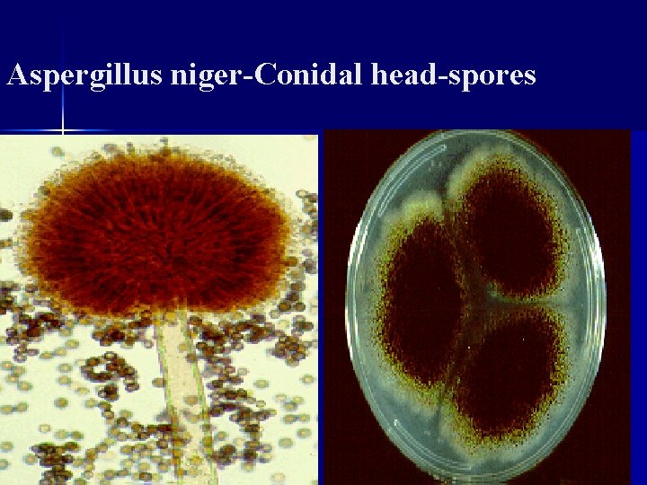 Aspergillus niger-Conidal head-spores 