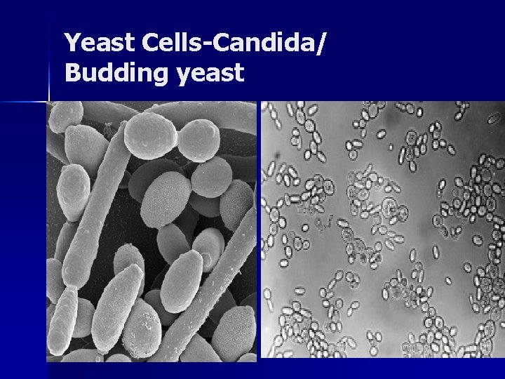 Yeast Cells-Candida/ Budding yeast 