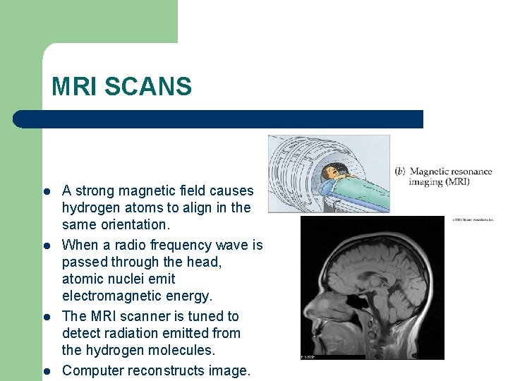 MRI SCANS l l A strong magnetic field causes hydrogen atoms to align in