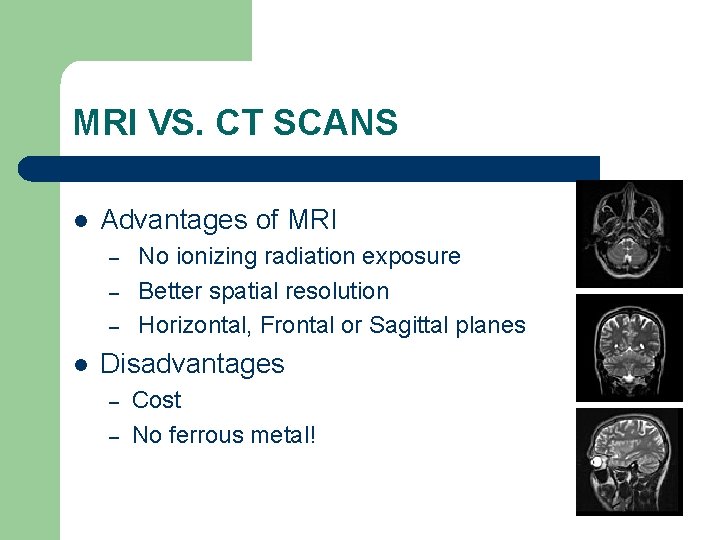 MRI VS. CT SCANS l Advantages of MRI – – – l No ionizing