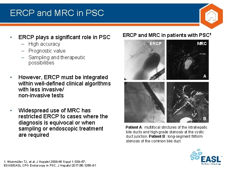 ERCP and MRC in PSC • ERCP plays a significant role in PSC –