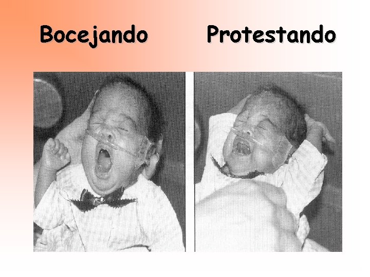 Bocejando Protestando 