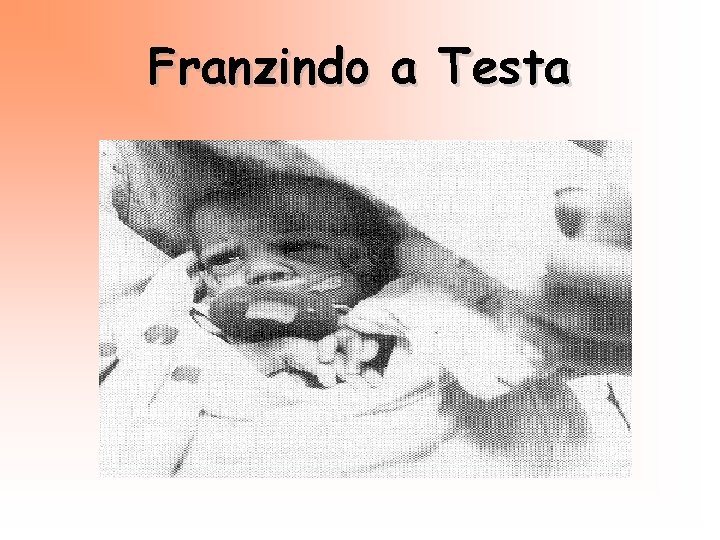 Franzindo a Testa 