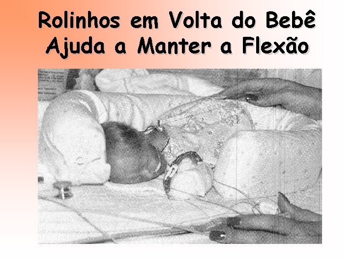 Rolinhos em Volta do Bebê Ajuda a Manter a Flexão 