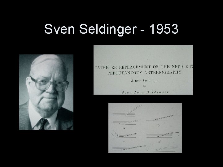 Sven Seldinger - 1953 