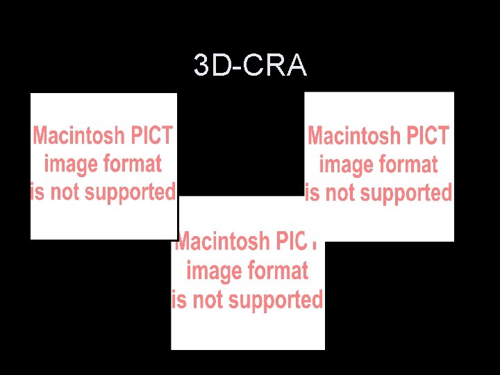3 D-CRA 