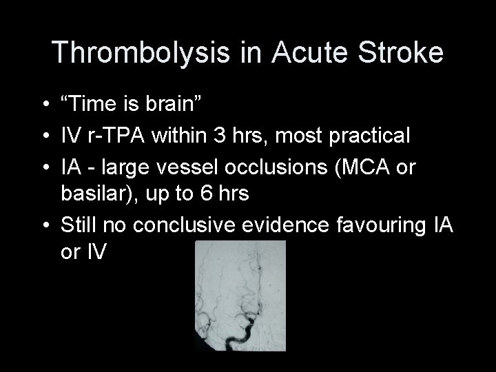 Thrombolysis in Acute Stroke • “Time is brain” • IV r-TPA within 3 hrs,