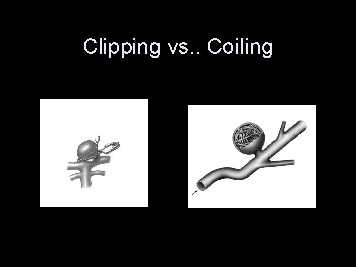 Clipping vs. . Coiling 
