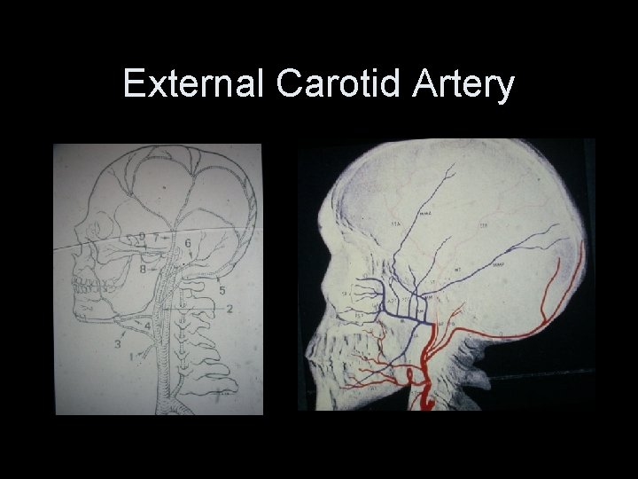 External Carotid Artery 