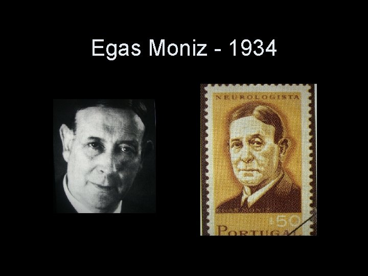Egas Moniz - 1934 