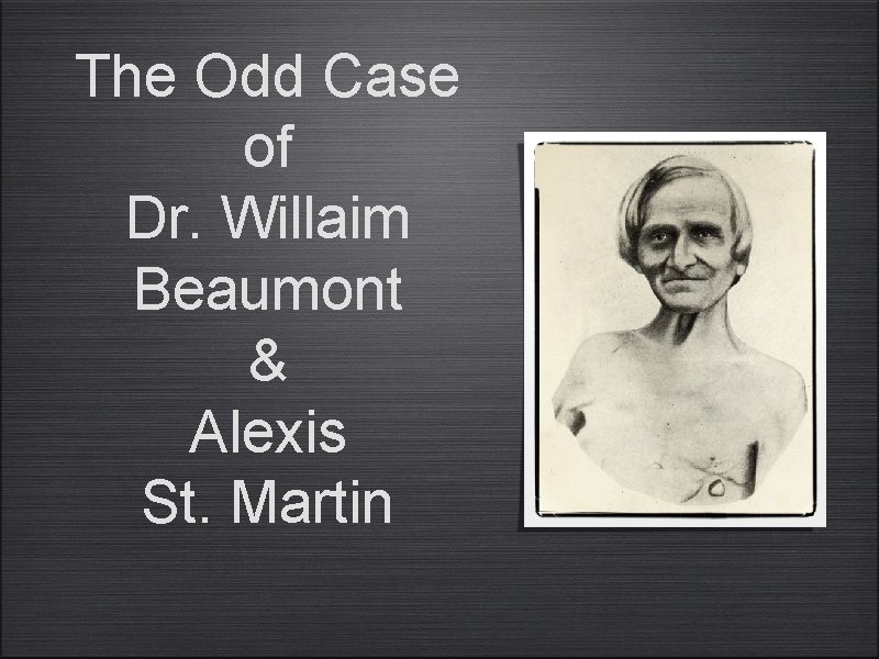 The Odd Case of Dr. Willaim Beaumont & Alexis St. Martin 