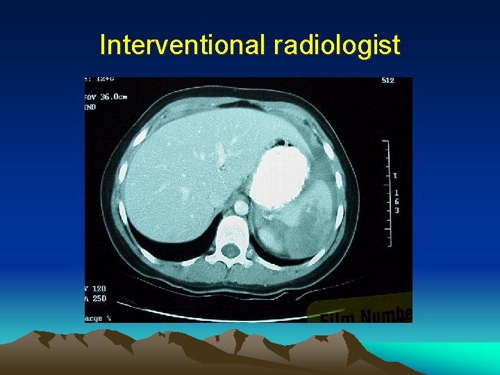 Interventional radiologist 