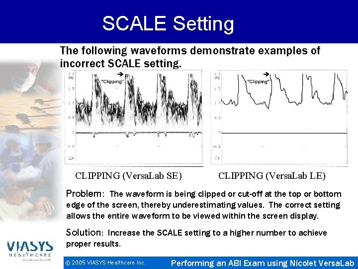 SCALE Setting The following waveforms demonstrate examples of incorrect SCALE setting. CLIPPING (Versa. Lab
