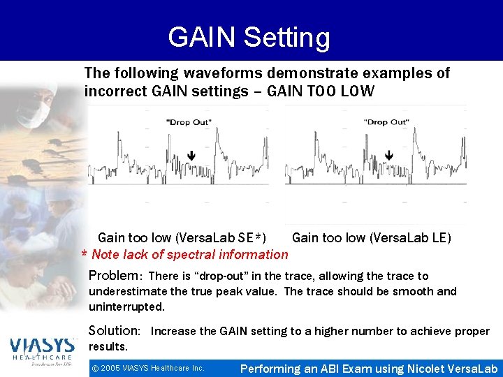 GAIN Setting The following waveforms demonstrate examples of incorrect GAIN settings – GAIN TOO