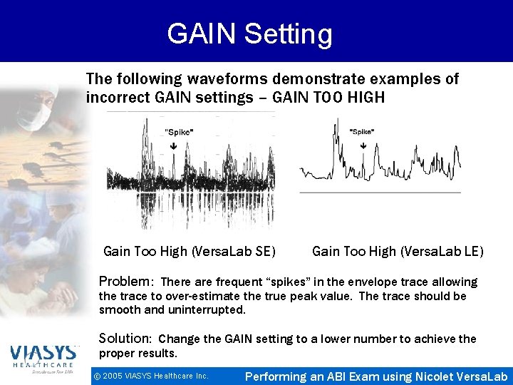 GAIN Setting The following waveforms demonstrate examples of incorrect GAIN settings – GAIN TOO