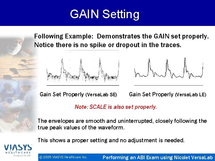 GAIN Setting Following Example: Demonstrates the GAIN set properly. Notice there is no spike