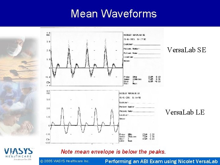 Mean Waveforms Versa. Lab SE Versa. Lab LE Note mean envelope is below the