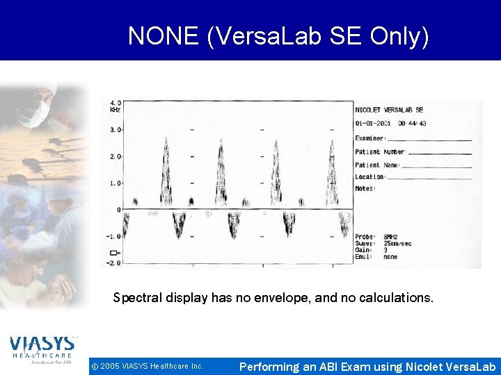 NONE (Versa. Lab SE Only) Spectral display has no envelope, and no calculations. ©