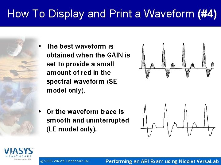 How To Display and Print a Waveform (#4) • The best waveform is obtained