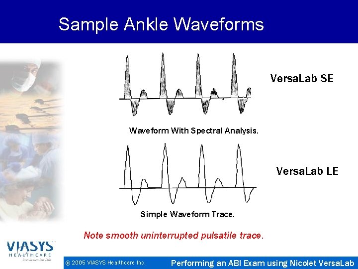 Sample Ankle Waveforms Versa. Lab SE Waveform With Spectral Analysis. Versa. Lab LE Simple
