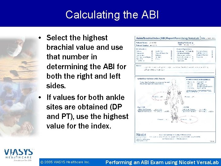 Calculating the ABI • Select the highest brachial value and use that number in