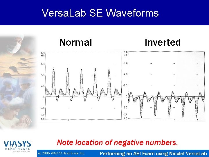 Versa. Lab SE Waveforms Normal Inverted Note location of negative numbers. © 2005 VIASYS