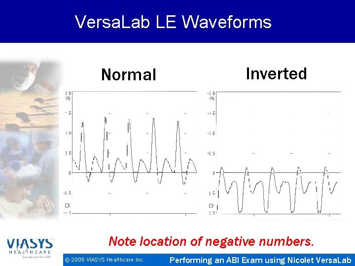 Versa. Lab LE Waveforms Normal Inverted Note location of negative numbers. © 2005 VIASYS