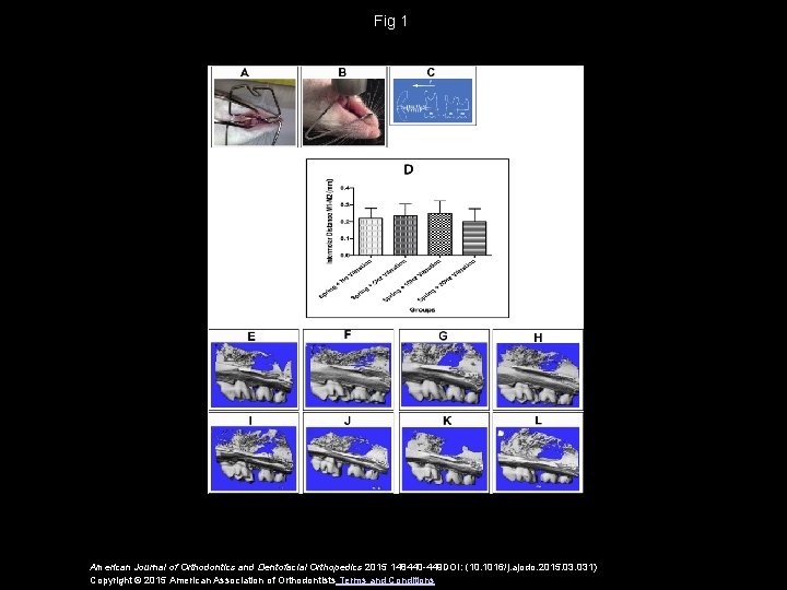 Fig 1 American Journal of Orthodontics and Dentofacial Orthopedics 2015 148440 -449 DOI: (10.