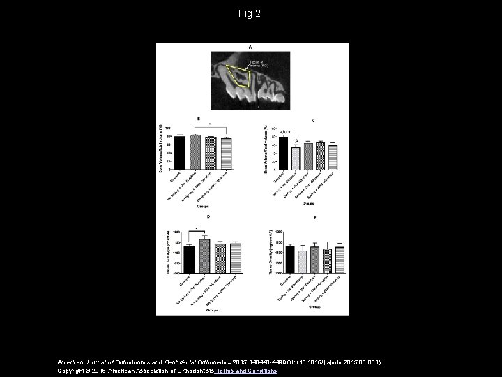 Fig 2 American Journal of Orthodontics and Dentofacial Orthopedics 2015 148440 -449 DOI: (10.