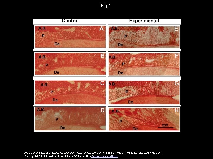 Fig 4 American Journal of Orthodontics and Dentofacial Orthopedics 2015 148440 -449 DOI: (10.