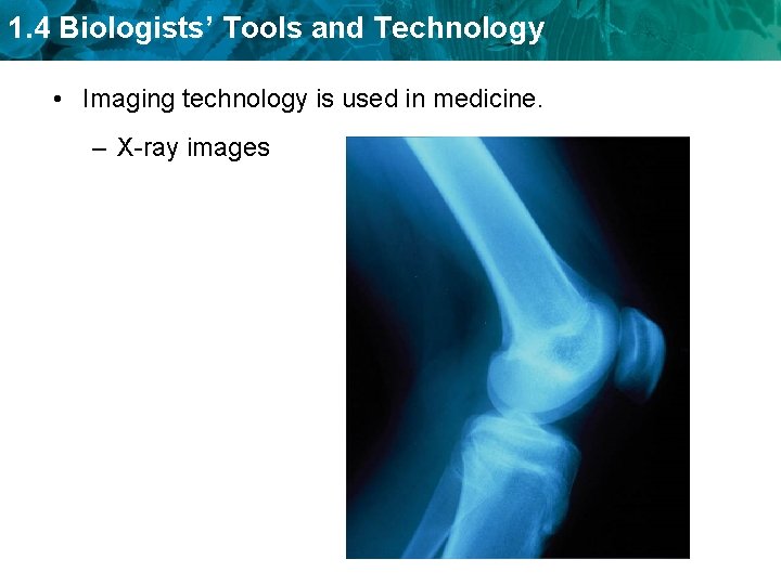 1. 4 Biologists’ Tools and Technology • Imaging technology is used in medicine. –