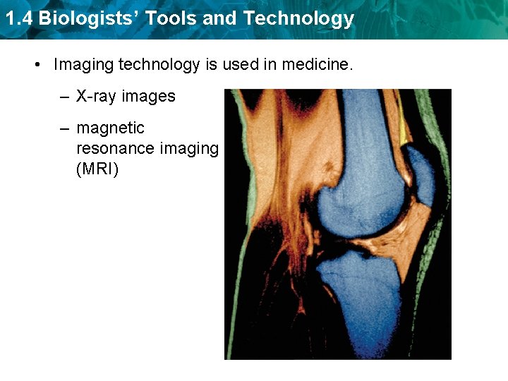 1. 4 Biologists’ Tools and Technology • Imaging technology is used in medicine. –