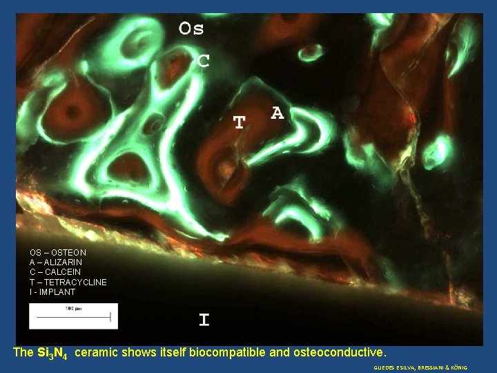 OS – OSTEON A – ALIZARIN C – CALCEIN T – TETRACYCLINE I -