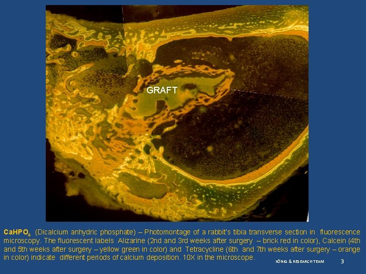 GRAFT Ca. HPO 4 (Dicalcium anhydric phosphate) – Photomontage of a rabbit’s tibia transverse