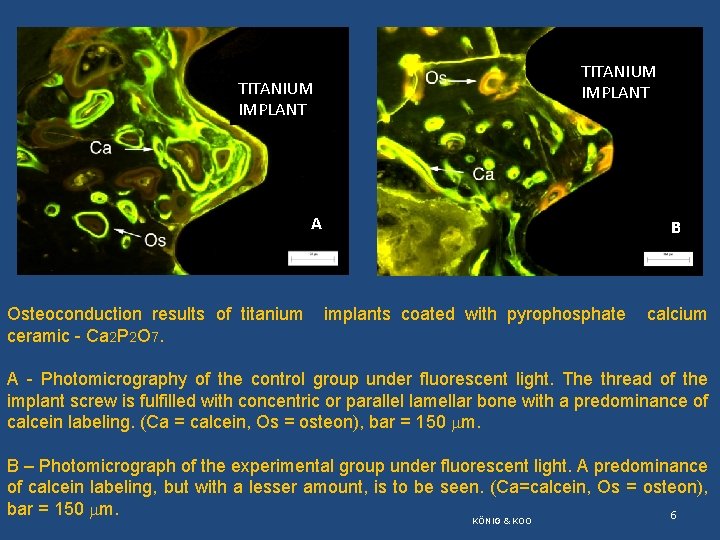 TITANIUM IMPLANT A Osteoconduction results of titanium ceramic - Ca 2 P 2 O