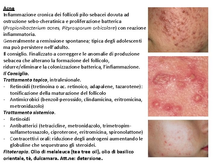 Acne Infiammazione cronica dei follicoli pilo-sebacei dovuta ad ostruzione sebo-cheratinica e proliferazione batterica (Propionibacterium