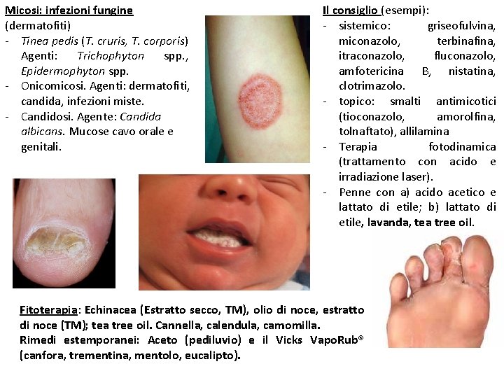Micosi: infezioni fungine (dermatofiti) - Tinea pedis (T. cruris, T. corporis) Agenti: Trichophyton spp.