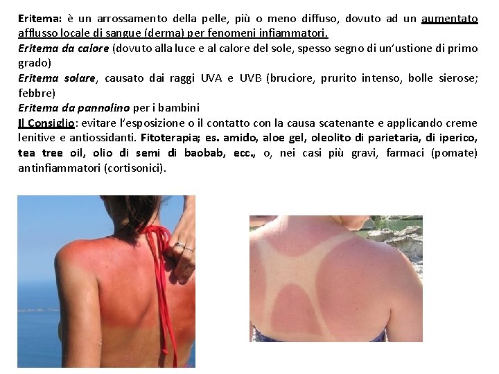 Eritema: è un arrossamento della pelle, più o meno diffuso, dovuto ad un aumentato