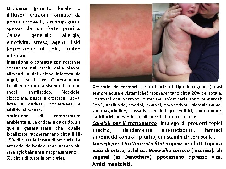 Orticaria (prurito locale o diffuso): eruzioni formate da pomfi arrossati, accompagnate spesso da un