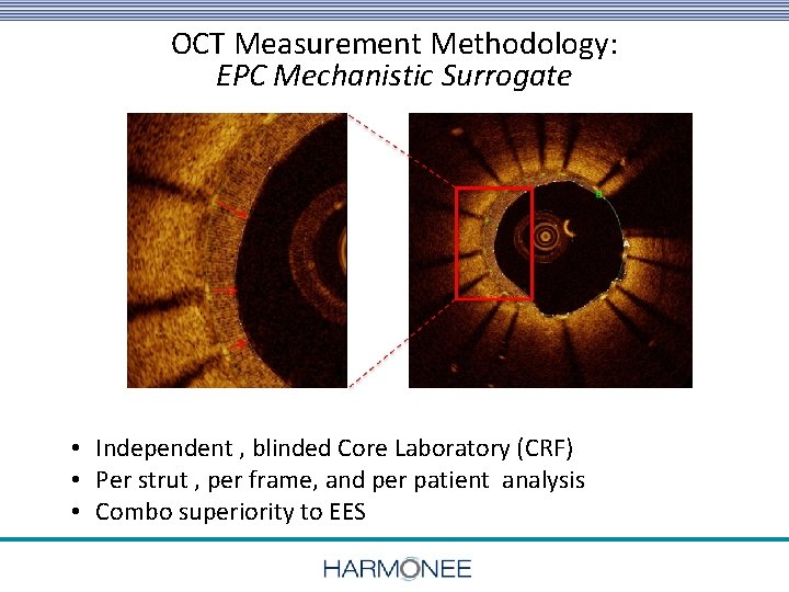 OCT Measurement Methodology: EPC Mechanistic Surrogate • Independent , blinded Core Laboratory (CRF) •