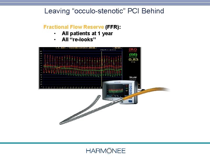 Leaving “occulo-stenotic” PCI Behind Physiologic & High Resolution Anatomic F/U Fractional Flow Reserve (FFR):