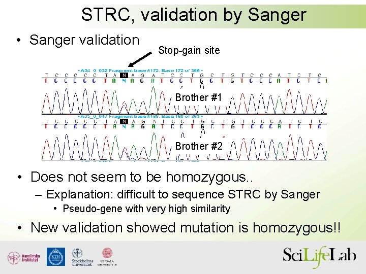 STRC, validation by Sanger • Sanger validation Stop-gain site Brother #1 Brother #2 •