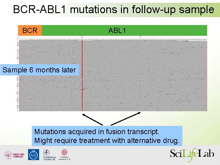 BCR-ABL 1 mutations in follow-up sample BCR ABL 1 Sample 6 months later Mutations