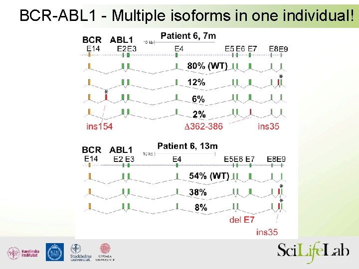 BCR-ABL 1 - Multiple isoforms in one individual! 