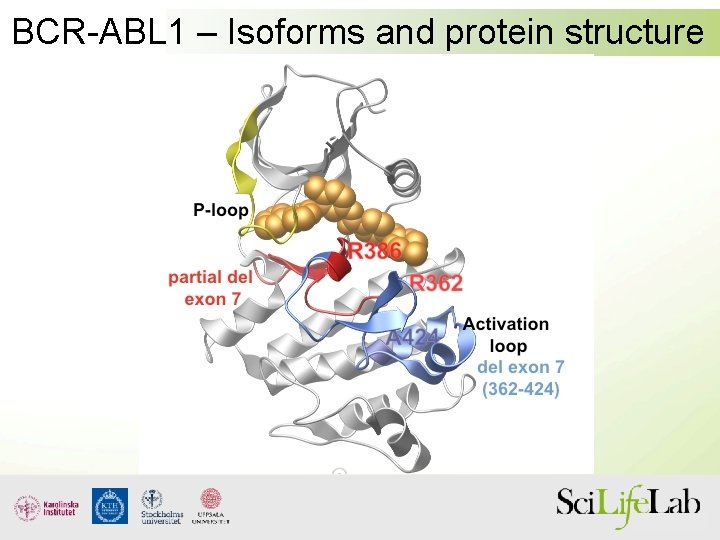 BCR-ABL 1 – Isoforms and protein structure 